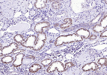 Activin Receptor Type IIB Rabbit Polyclonal Antibody