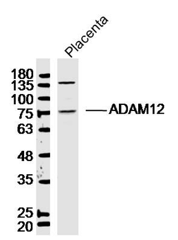 ADAM12 Rabbit Polyclonal Antibody