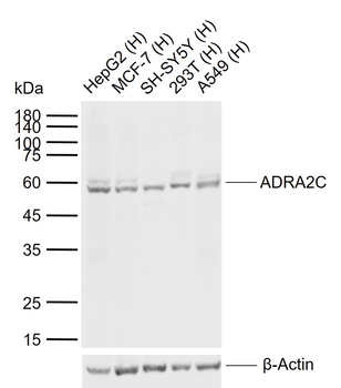 ADRA2C Rabbit Polyclonal Antibody