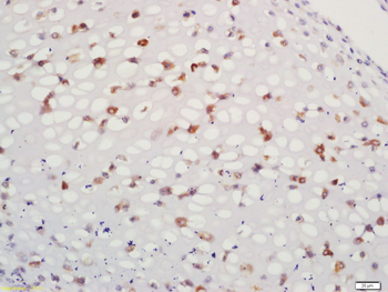 ACAN Rabbit Polyclonal Antibody