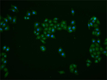 Phospho-AKT3 (Tyr473) Rabbit Polyclonal Antibody