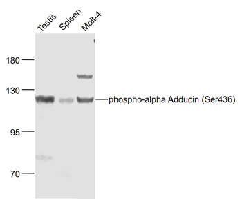 Phospho-alpha Adducin (Ser436) Rabbit Polyclonal Antibody