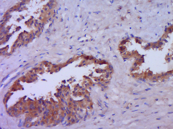 Phospho-AR/Androgen receptor (Ser94) Rabbit Polyclonal Antibody