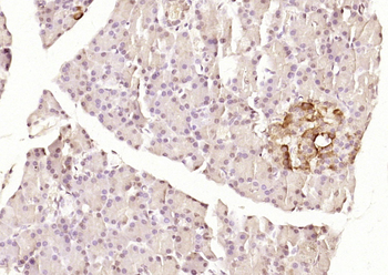 ANKRD5 Rabbit Polyclonal Antibody