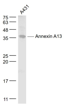 Annexin A13 Rabbit Polyclonal Antibody