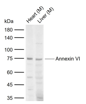 Annexin VI Rabbit Polyclonal Antibody