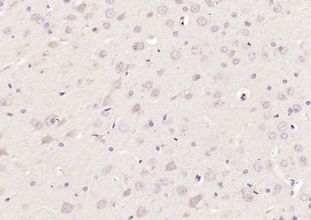 ANT1+ANT2+ANT3+ANT4 Rabbit Polyclonal Antibody