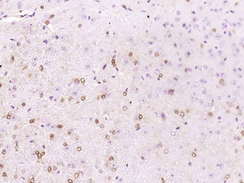APBA1 Rabbit Polyclonal Antibody