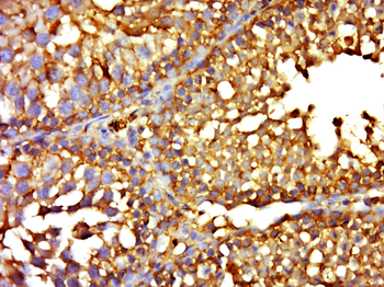 Phospho-APC1 (Ser688) Rabbit Polyclonal Antibody