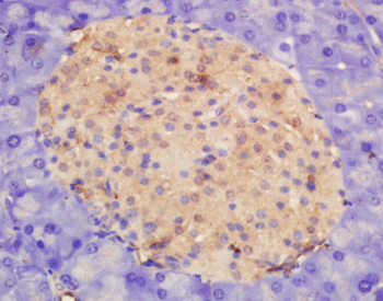 APOD Rabbit Polyclonal Antibody