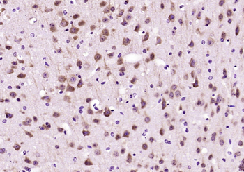 ARF5 Rabbit Polyclonal Antibody