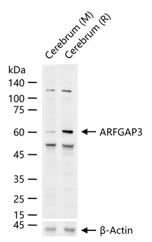 ARFGAP3 Rabbit Polyclonal Antibody