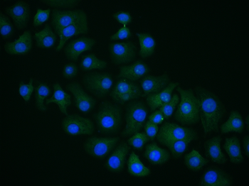 Arginase II Rabbit Polyclonal Antibody