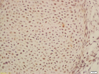 ARID1B Rabbit Polyclonal Antibody