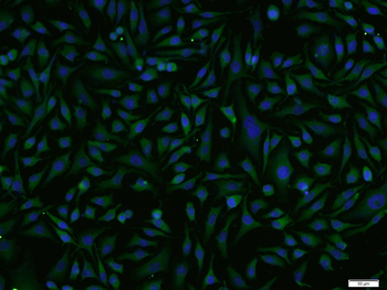 ARP3 Rabbit Polyclonal Antibody