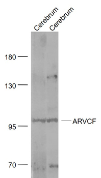 ARVCF Rabbit Polyclonal Antibody