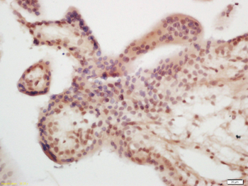 ASCL2 Rabbit Polyclonal Antibody
