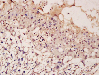 ASCL2 Rabbit Polyclonal Antibody