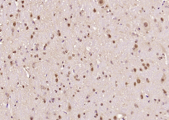 Ataxin 7 Rabbit Polyclonal Antibody