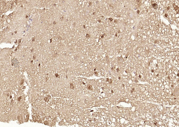 Ataxin 7 Rabbit Polyclonal Antibody