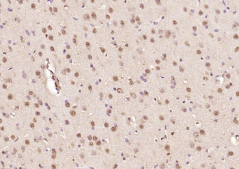 Ataxin 7 Rabbit Polyclonal Antibody