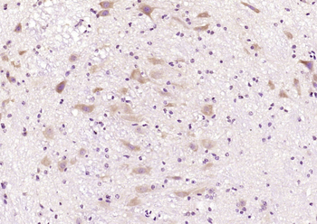 Phospho-ATF2 (Thr73 / Thr55) Rabbit Polyclonal Antibody