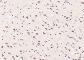 Phospho-ATF2 (Thr73 / Thr55) Rabbit Polyclonal Antibody