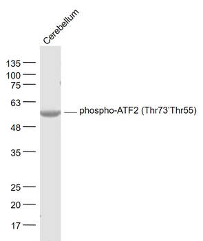 Phospho-ATF2 (Thr73 / Thr55) Rabbit Polyclonal Antibody