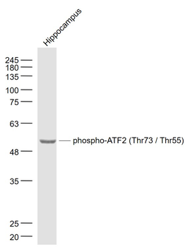 Phospho-ATF2 (Thr73 / Thr55) Rabbit Polyclonal Antibody