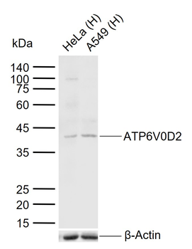 ATP6V0D2 Rabbit Polyclonal Antibody