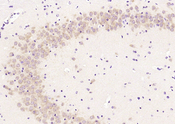 BBS1 Rabbit Polyclonal Antibody