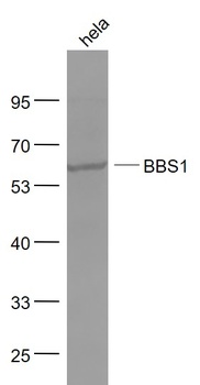 BBS1 antibody