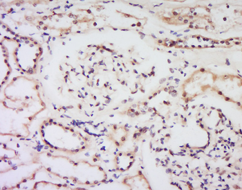 Bcl-2 alpha Rabbit Polyclonal Antibody