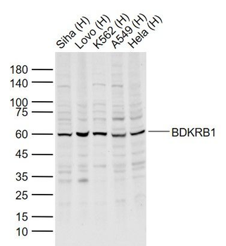 BDKRB1 Rabbit Polyclonal Antibody