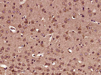 BDNF Rabbit Polyclonal Antibody