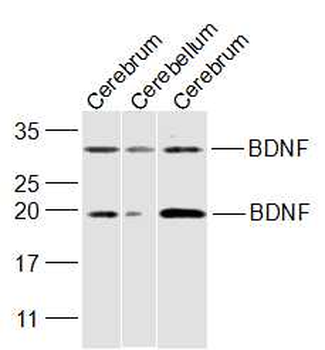 BDNF Rabbit Polyclonal Antibody
