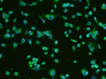 BDNF Rabbit Polyclonal Antibody