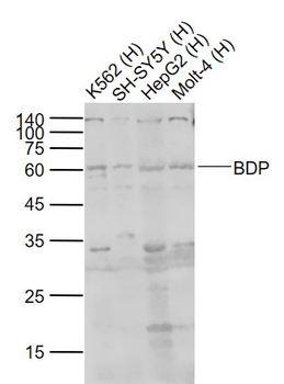 BDP Rabbit Polyclonal Antibody