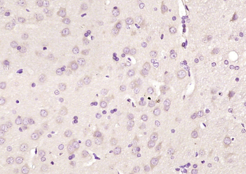 Beta B1 Crystallin Rabbit Polyclonal Antibody