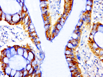 Phospho-beta Catenin (Ser33) Rabbit Polyclonal Antibody