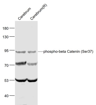 beta Catenin (Phospho-Ser37) antibody