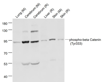 Phospho-beta Catenin (Tyr333) Rabbit Polyclonal Antibody