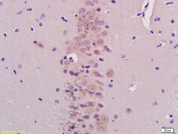 BHLHB9/p60TRP Rabbit Polyclonal Antibody