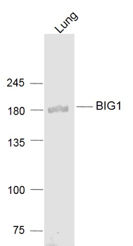 BIG1 Rabbit Polyclonal Antibody