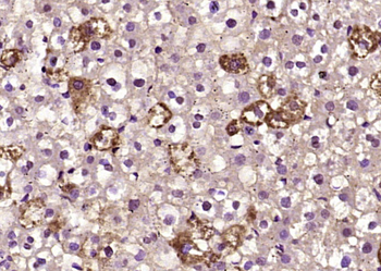 BLMH Rabbit Polyclonal Antibody