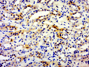 Biliverdin Reductase Rabbit Polyclonal Antibody
