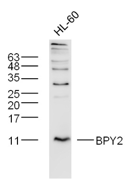 BPY2 Rabbit Polyclonal Antibody