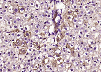 BTD Rabbit Polyclonal Antibody