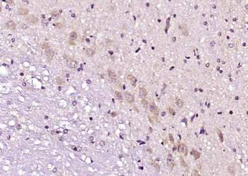 BZW1 Rabbit Polyclonal Antibody