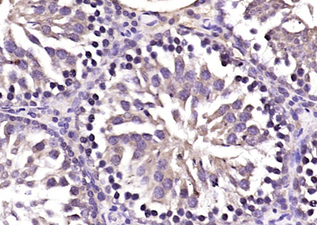BZW1 Rabbit Polyclonal Antibody